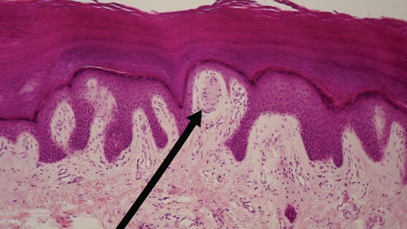 Light micrograph of a Meissner corpuscle, an elongated capsule of stacked cell layers sitting inside a dermal papilla just beneath the skin surface
